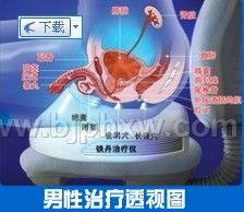 前列腺治疗仪(铁丹治疗仪)